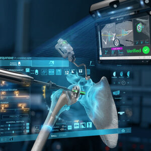 Exactech Shoulder GPS Active Intelligence